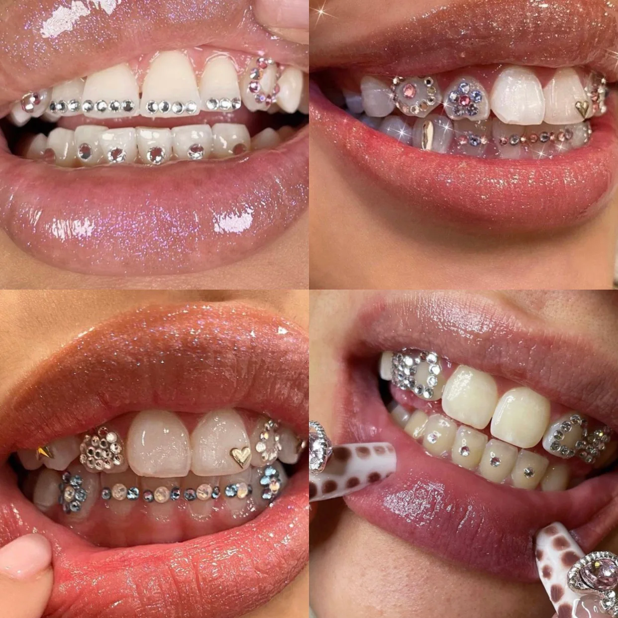 Tooth Gem Designs A Sparkling Trend in Cosmetic Dentistry